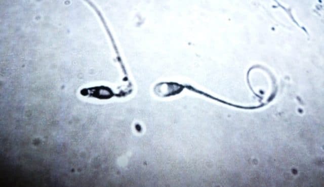 Los espermatozoides deben llegar a la trompa de Falopio