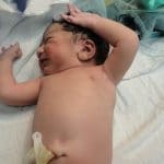 Cuidado del cordon umbilical