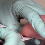 Se toman muestras para anliisis de enfermedades hereditarias