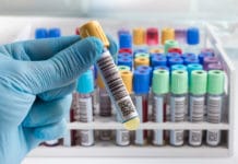 Qué es el test de O´Sullivan