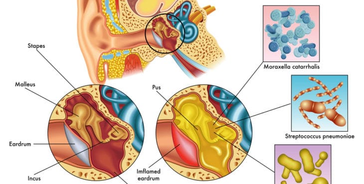 Anatomía del oído medio 