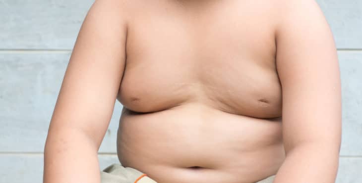 obesidad infantil y los hábitos