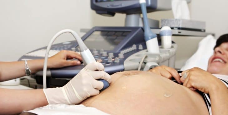 Control sobre el embarazo y el movimiento fetal