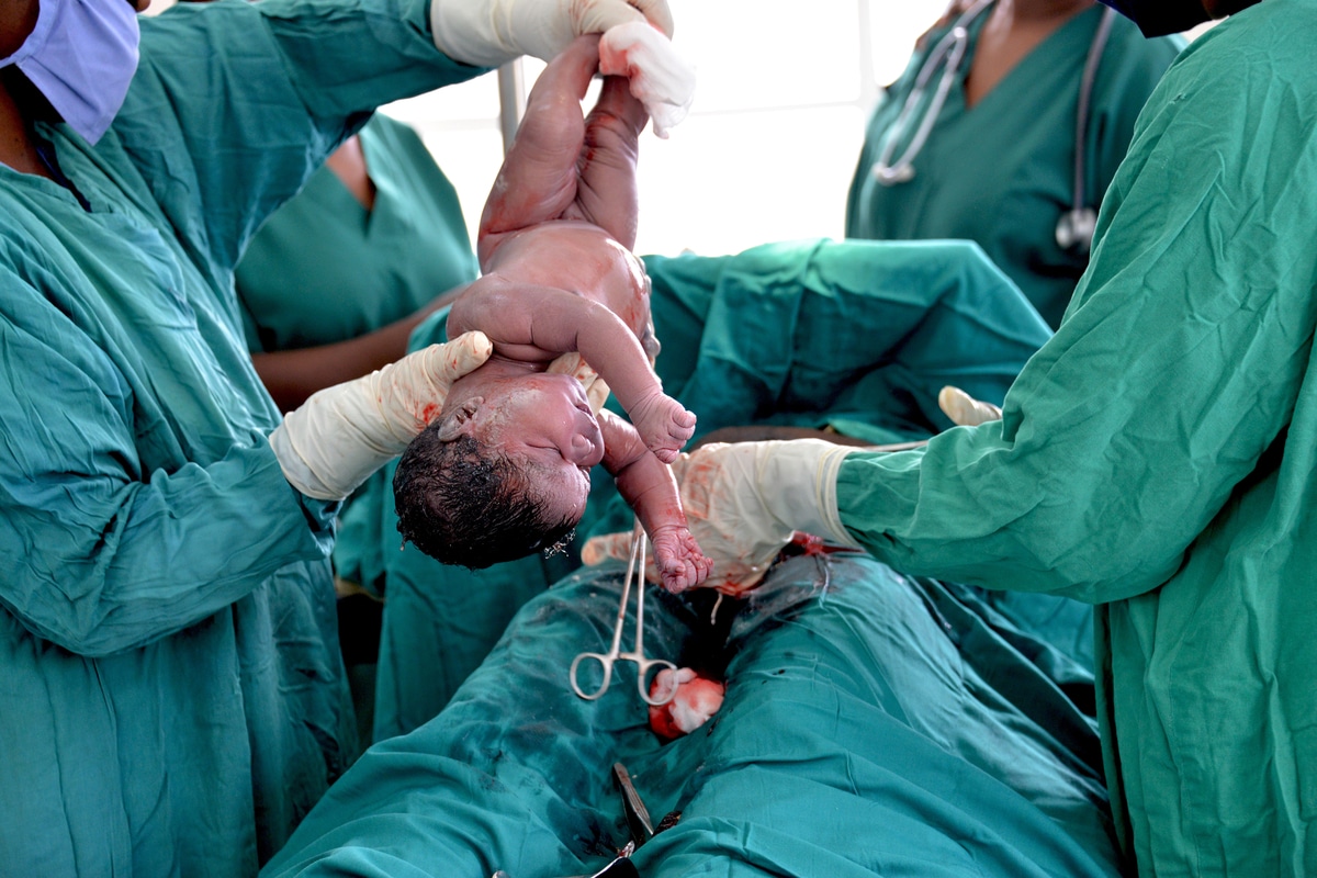 Médicos en una cesárea