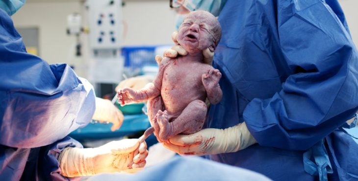 Bebé nacido por cesárea