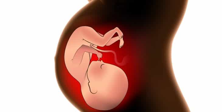 Complicaciones del feto y de la madre
