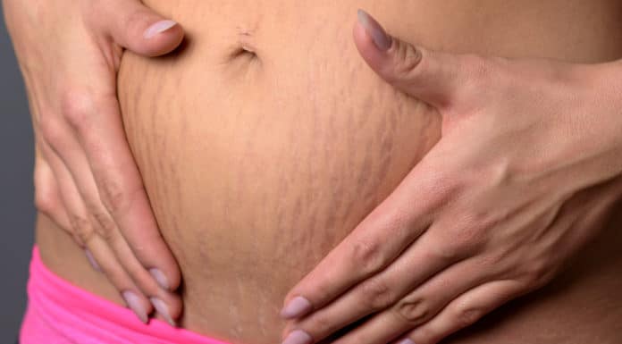 Elementos a tomar en cuenta para saber cómo cuidar la piel en el embarazo