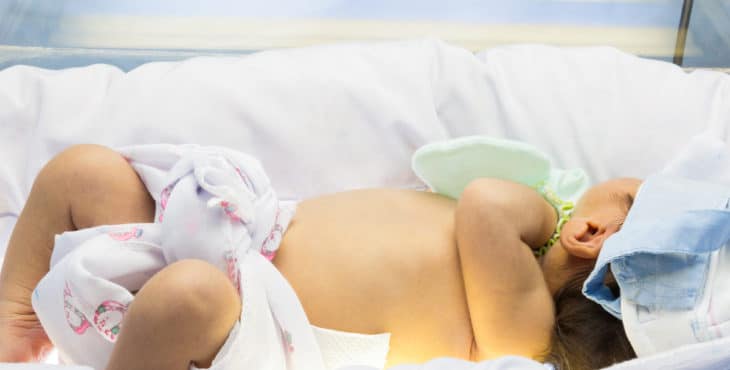 Recién nacido con ictericia neonatal