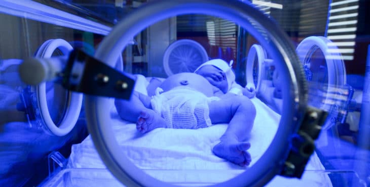 Recién nacido bajo luz ultravioleta en la incubadora