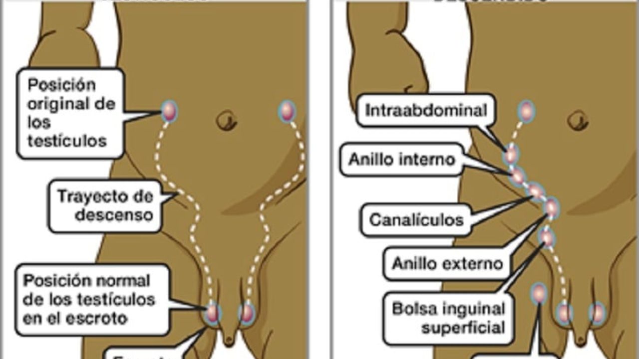 Sintomas de testiculos no descendidos