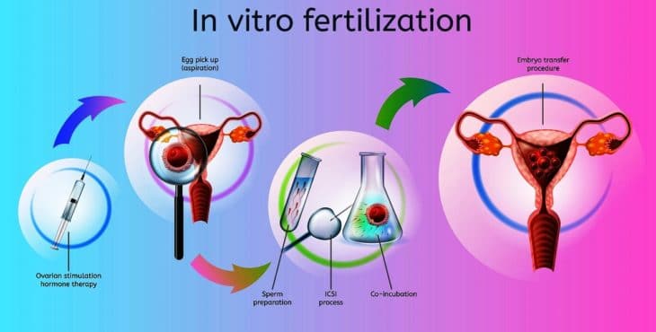 Fecundación in vitro