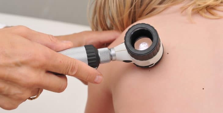 Dermatoscopio en un niño