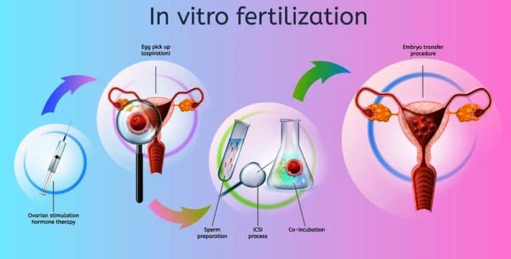 Pasos de la fertilización in vitro