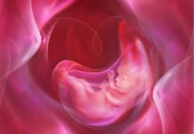 Aborto espontáneo