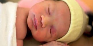 recién nacidos Un tipo de mancha en la piel