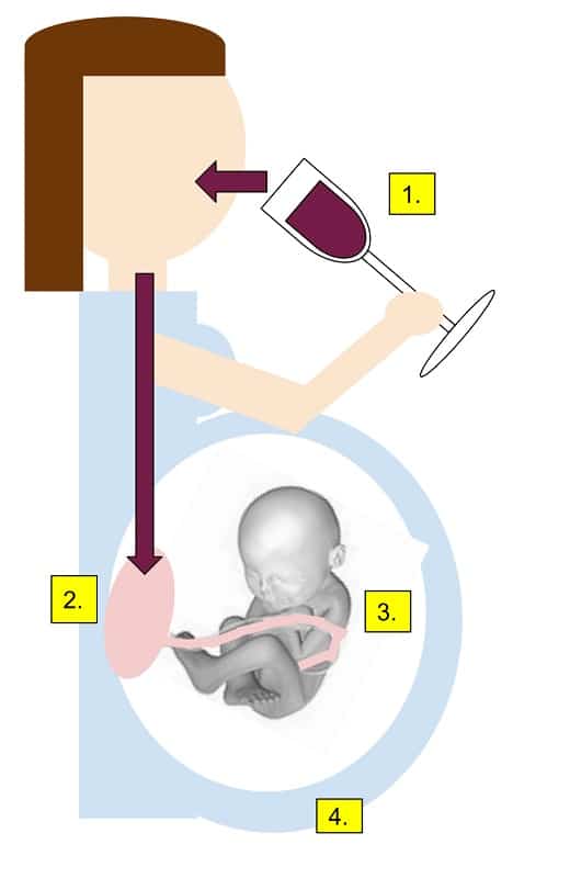 2-Los Trastornos Del Espectro Alcohólico Fetal Están Asociados Al ...