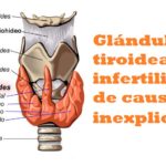 1-Glándula tiroidea y la infertilidad de causa inexplicable – Copy