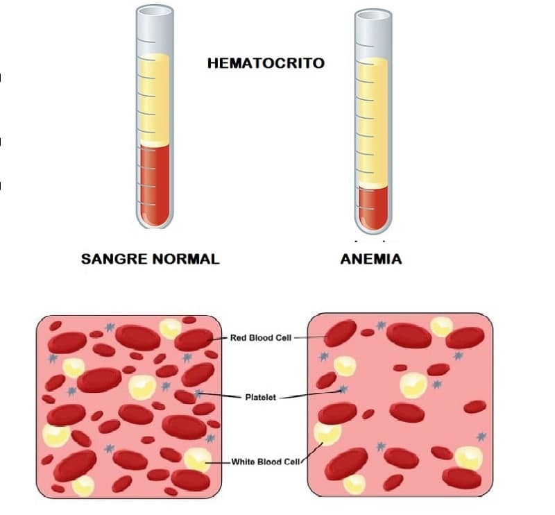 4-Anemia y sangre normal - Canal Chupete