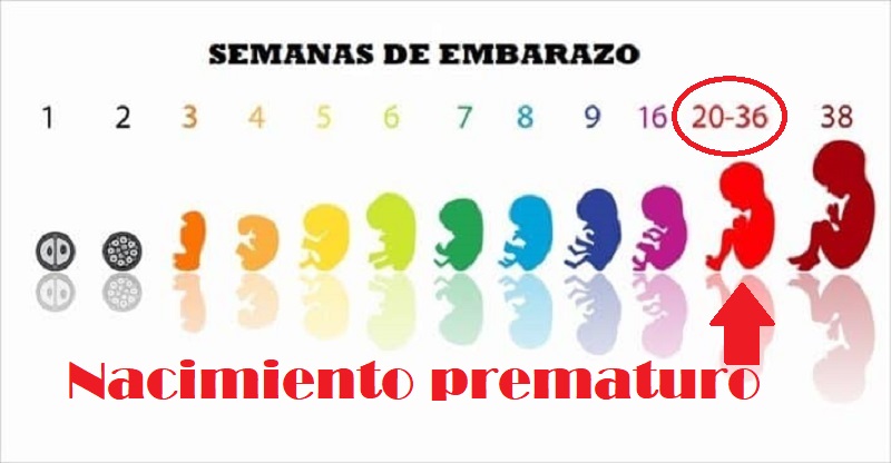 ¿Qué es un nacimiento prematuro y cuales sus factores de riesgo?