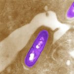 3-La listeria monocytogenes